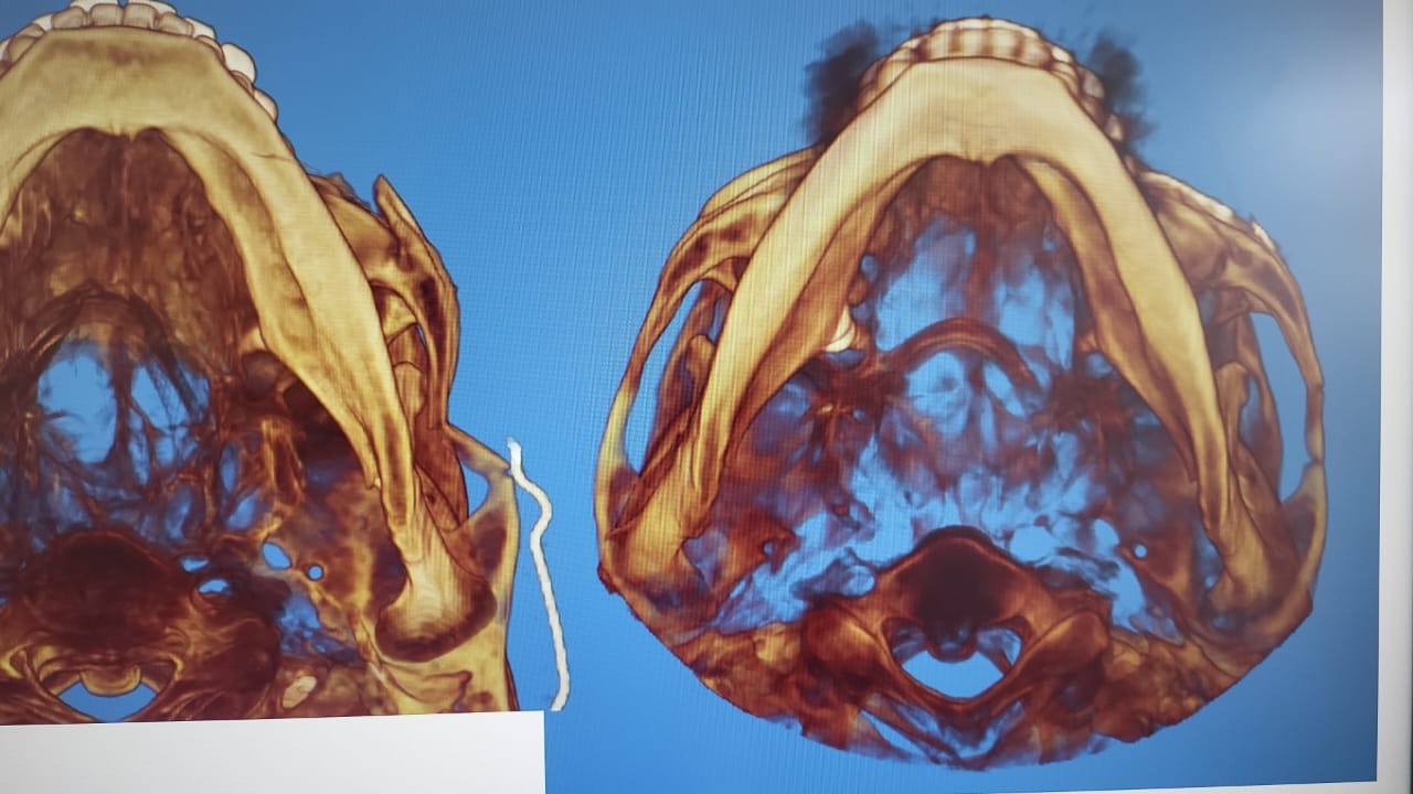 Cirugía guiada por ordenador: tecnología de vanguardia en cirugía maxilofacial